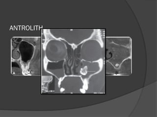 advanced imaging in dentistry and its applied aspects | PPTX
