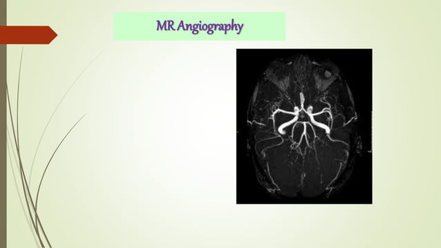 Advanced imaging mri | PPTX