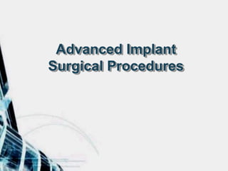Advanced Implant
Surgical Procedures
 