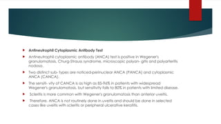 ADVANCED INVESTIGATIONS IN UVEITIS .pptx