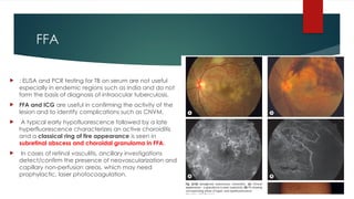 ADVANCED INVESTIGATIONS IN UVEITIS .pptx