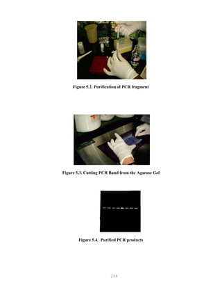 204
Figure 5.2. Purification of PCR fragment
Figure 5.3. Cutting PCR Band from the Agarose Gel
Figure 5.4. Purified PCR products
 