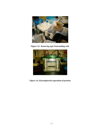 354
Figure 1.5. Removing agar from loading well.
Figure 1.6. Electrophoretic separation of proteins
 