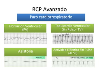 RCP Avanzado
Paro cardiorrespiratorio
Taquicardia Ventricular
Sin Pulso (TV)
Fibrilación Ventricular
(FV)
Asistolia Actividad Eléctrica Sin Pulso
(AESP)
 