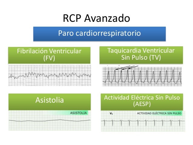 Advanced life support/ RCP avanzado