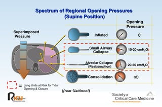 Spectrum of Regional Opening Pressures
Spectrum of Regional Opening Pressures
(Supine Position)
(Supine Position)
Superimposed
Pressure Inflated 0
Alveolar Collapse
(Reabsorption) 20-60 cmH2O
Small Airway
Collapse
10-20 cmH2O
Consolidation 
(from Gattinoni)
)
Lung Units at Risk for Tidal
Opening & Closure
=
Opening
Pressure
 