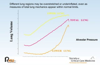 Different lung regions may be overstretched or underinflated, even as
measures of total lung mechanics appear within normal limits.
Alveolar Pressure
Lung
Volume
UPPER LUNG
TOTAL LUNG
LOWER LUNG
 