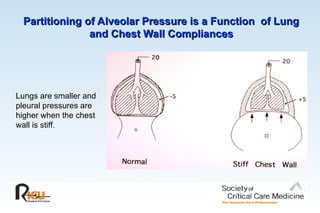 Partitioning of Alveolar Pressure is a Function of Lung
Partitioning of Alveolar Pressure is a Function of Lung
and Chest Wall Compliances
and Chest Wall Compliances
Lungs are smaller and
pleural pressures are
higher when the chest
wall is stiff.
 