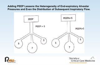 Adding PEEP Lessens the Heterogeneity of End-expiratory Alveolar
Pressures and Even the Distribution of Subsequent Inspiratory Flow.
 