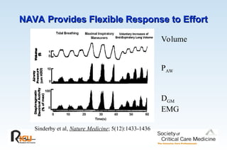 NAVA Provides Flexible Response to Effort
NAVA Provides Flexible Response to Effort
Volume
PAW
DGM
EMG
Sinderby et al, Nature Medicine; 5(12):1433-1436
 