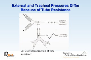 External and Tracheal Pressures Differ
External and Tracheal Pressures Differ
Because of Tube Resistance
Because of Tube Resistance
ATC offsets a fraction of tube
resistance
 