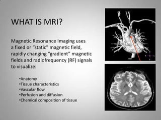Advanced medical imaging mri safety 2013 | PPTX