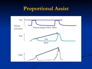 Proportional Assist Airway assistance 