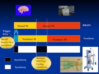 Ventilator TE Neural TI Neural TE Trigger delay Ventilator TI Asynchrony Synchrony BRAIN Ventilator Missed breaths/flow asynchrony Runways INS/Exp Cycling asynchrony 