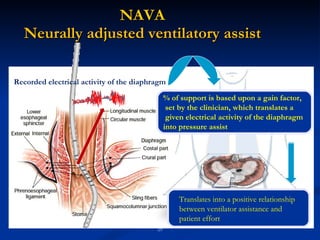 NAVA   Neurally adjusted ventilatory assist  Recorded electrical activity of the diaphragm % of support is based upon a gain factor, set by the clinician, which translates a given electrical activity of the diaphragm into pressure assist Translates into a positive relationship between ventilator assistance and patient effort Esophagus 