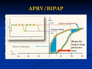 APRV/BIPAP Maintain high FRC-better oxygenation Lung in safe zone-less de-recruitment /VILI Spontaneous breaths- diaphragm is active hence less VIDD/better Hemodynamics Less sedation and analgesia? Conflicting results APRV is IRV hence more impetus on Oxygenation/ synchrony problems persist BIPAP less IRV less synchrony problems Keeps the lung in lung protective zone Zone of Atelectasis 