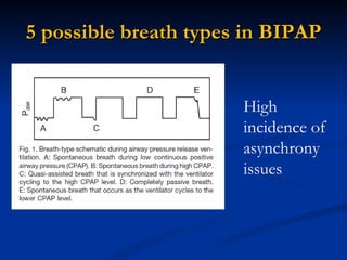 5 possible breath types in BIPAP High incidence of asynchrony issues 