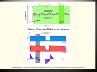 Advanced MODES of ventilation Module 1 TRC copy.pptx