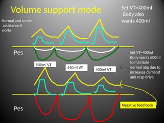 Volume Support Mode Advanced MODES of ventilation Module 1 TRC copy.pptx