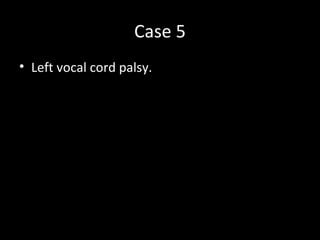 Case 5
• Left vocal cord palsy.
 
