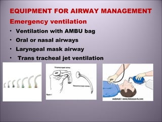 EQUIPMENT FOR AIRWAY MANAGEMENT
Emergency ventilation
• Ventilation with AMBU bag
• Oral or nasal airways
• Laryngeal mask airway
• Trans tracheal jet ventilation
 