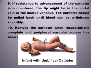 9. If resistance to advancement of the catheter
is encountered, the tip might be in the portal
vein or the ductus venosus. The catheter should
be pulled back until blood can be withdrawn
smoothly.
10. Remove the catheter when resuscitations
complete and peripheral vascular access has
been obtained.
 