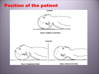 Position of the patient
 