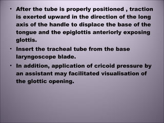 • After the tube is properly positioned , traction
is exerted upward in the direction of the long
axis of the handle to displace the base of the
tongue and the epiglottis anteriorly exposing
glottis.
• Insert the tracheal tube from the base
laryngoscope blade.
• In addition, application of cricoid pressure by
an assistant may facilitated visualisation of
the glottic opening.
 