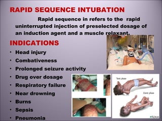 RAPID SEQUENCE INTUBATION
Rapid sequence in refers to the rapid
uninterrupted injection of preselected dosage of
an induction agent and a muscle relaxant.
INDICATIONS
• Head injury
• Combativeness
• Prolonged seizure activity
• Drug over dosage
• Respiratory failure
• Near drowning
• Burns
• Sepsis
• Pneumonia
 