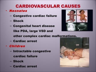 • Neonates
– Congestive cardiac failure
– Shock
– Congenital heart disease
like PDA, large VSD and
other complex cardiac malformations.
– Cardiac arrest
• Children
– Intractable congestive
cardiac failure
– Shock
– Cardiac arrest
 