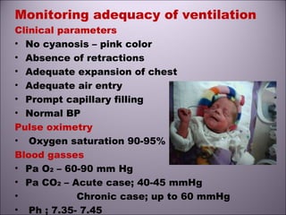 Monitoring adequacy of ventilation
Clinical parameters
• No cyanosis – pink color
• Absence of retractions
• Adequate expansion of chest
• Adequate air entry
• Prompt capillary filling
• Normal BP
Pulse oximetry
• Oxygen saturation 90-95%
Blood gasses
• Pa O2 – 60-90 mm Hg
• Pa CO2 – Acute case; 40-45 mmHg
• Chronic case; up to 60 mmHg
• Ph ; 7.35- 7.45
 