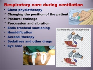 Respiratory care during ventilation
• Chest physiotherapy
 Changing the position of the patient
 Postural drainage
 Percussion and vibration
• Endo tracheal suctioning
• Humidification
• Aerosal therapy
• Sedatives and other drugs
• Eye care
 