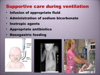 Supportive care during ventilation
• Infusion of appropriate fluid
• Administration of sodium bicorbonate
• Inotropic agents
• Appropriate antibiotics
• Nasogastric feeding
• X-ray chest
 
