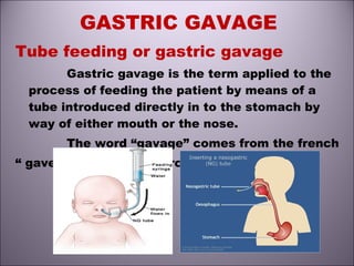 GASTRIC GAVAGE
Tube feeding or gastric gavage
Gastric gavage is the term applied to the
process of feeding the patient by means of a
tube introduced directly in to the stomach by
way of either mouth or the nose.
The word “gavage” comes from the french
“ gaver” meaning to “ force feeding of poultry”.
 