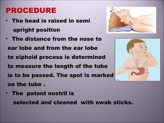 PROCEDURE
• The head is raised in semi
upright position
• The distance from the nose to
ear lobe and from the ear lobe
to xiphoid process is determined
to measure the length of the tube
is to be passed. The spot is marked
on the tube .
• The patent nostril is
selected and cleaned with swab sticks.
 