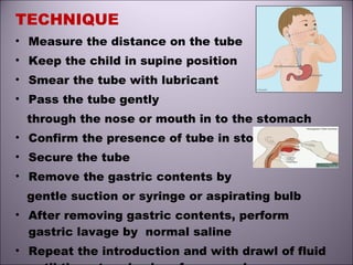 TECHNIQUE
• Measure the distance on the tube
• Keep the child in supine position
• Smear the tube with lubricant
• Pass the tube gently
through the nose or mouth in to the stomach
• Confirm the presence of tube in stomach
• Secure the tube
• Remove the gastric contents by
gentle suction or syringe or aspirating bulb
• After removing gastric contents, perform
gastric lavage by normal saline
• Repeat the introduction and with drawl of fluid
 