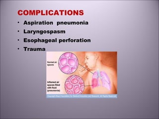 COMPLICATIONS
• Aspiration pneumonia
• Laryngospasm
• Esophageal perforation
• Trauma
 