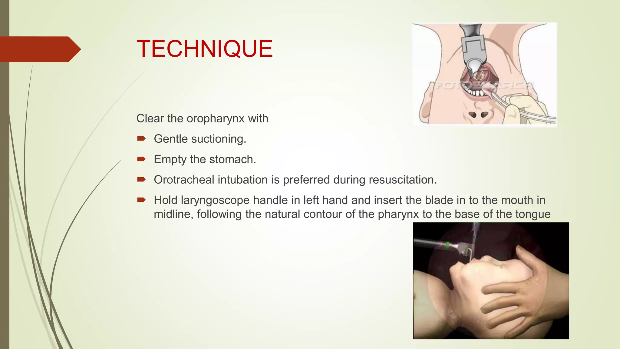 TECHNIQUE
Clear the oropharynx with
 Gentle suctioning.
 Empty the stomach.
 Orotracheal intubation is preferred during resuscitation.
 Hold laryngoscope handle in left hand and insert the blade in to the mouth in
midline, following the natural contour of the pharynx to the base of the tongue
 