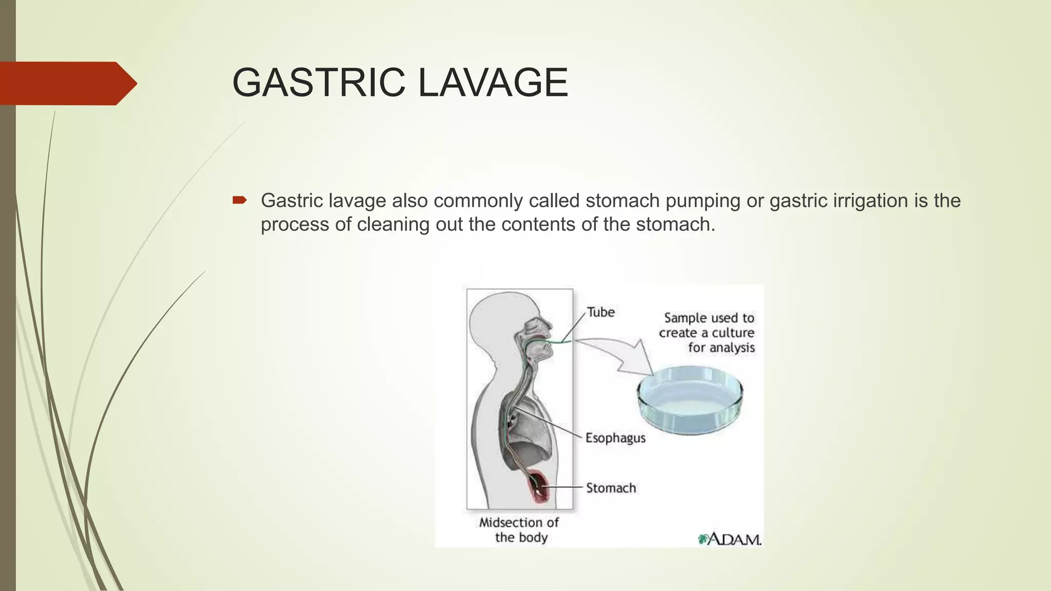 GASTRIC LAVAGE
 Gastric lavage also commonly called stomach pumping or gastric irrigation is the
process of cleaning out the contents of the stomach.
 