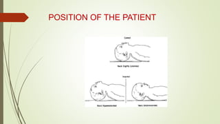 POSITION OF THE PATIENT
 