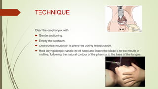 TECHNIQUE
Clear the oropharynx with
 Gentle suctioning.
 Empty the stomach.
 Orotracheal intubation is preferred during resuscitation.
 Hold laryngoscope handle in left hand and insert the blade in to the mouth in
midline, following the natural contour of the pharynx to the base of the tongue
 
