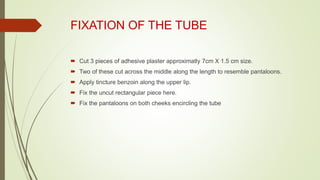 FIXATION OF THE TUBE
 Cut 3 pieces of adhesive plaster approximatly 7cm X 1.5 cm size.
 Two of these cut across the middle along the length to resemble pantaloons.
 Apply tincture benzoin along the upper lip.
 Fix the uncut rectangular piece here.
 Fix the pantaloons on both cheeks encircling the tube
 