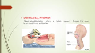  NASO TRACHEAL INTUBATION
Nasotrachealintubation where a tubeis passed through the nose,
larynx, vocal cords and trachea
 
