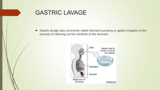 GASTRIC LAVAGE
 Gastric lavage also commonly called stomach pumping or gastric irrigation is the
process of cleaning out the contents of the stomach.
 