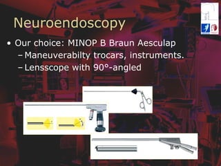 Neuroendoscopy
•  Our choice: MINOP B Braun Aesculap
– Maneuverabilty trocars, instruments.
– Lensscope with 90°-angled
 