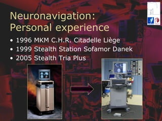 Neuronavigation:
Personal experience
•  1996 MKM C.H.R. Citadelle Liège
•  1999 Stealth Station Sofamor Danek
•  2005 Stealth Tria Plus
 