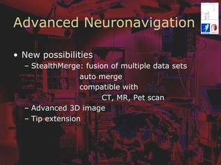 Advanced Neuronavigation
•  New possibilities
–  StealthMerge: fusion of multiple data sets
auto merge
compatible with
CT, MR, Pet scan
–  Advanced 3D image
–  Tip extension
 