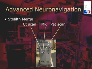 Advanced Neuronavigation
•  Stealth Merge
Ct scan MR Pet scan
 