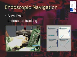 Endoscopic Navigation
•  Sure Trak
endoscope tracking
 