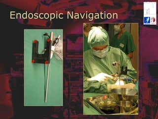 Endoscopic Navigation
 